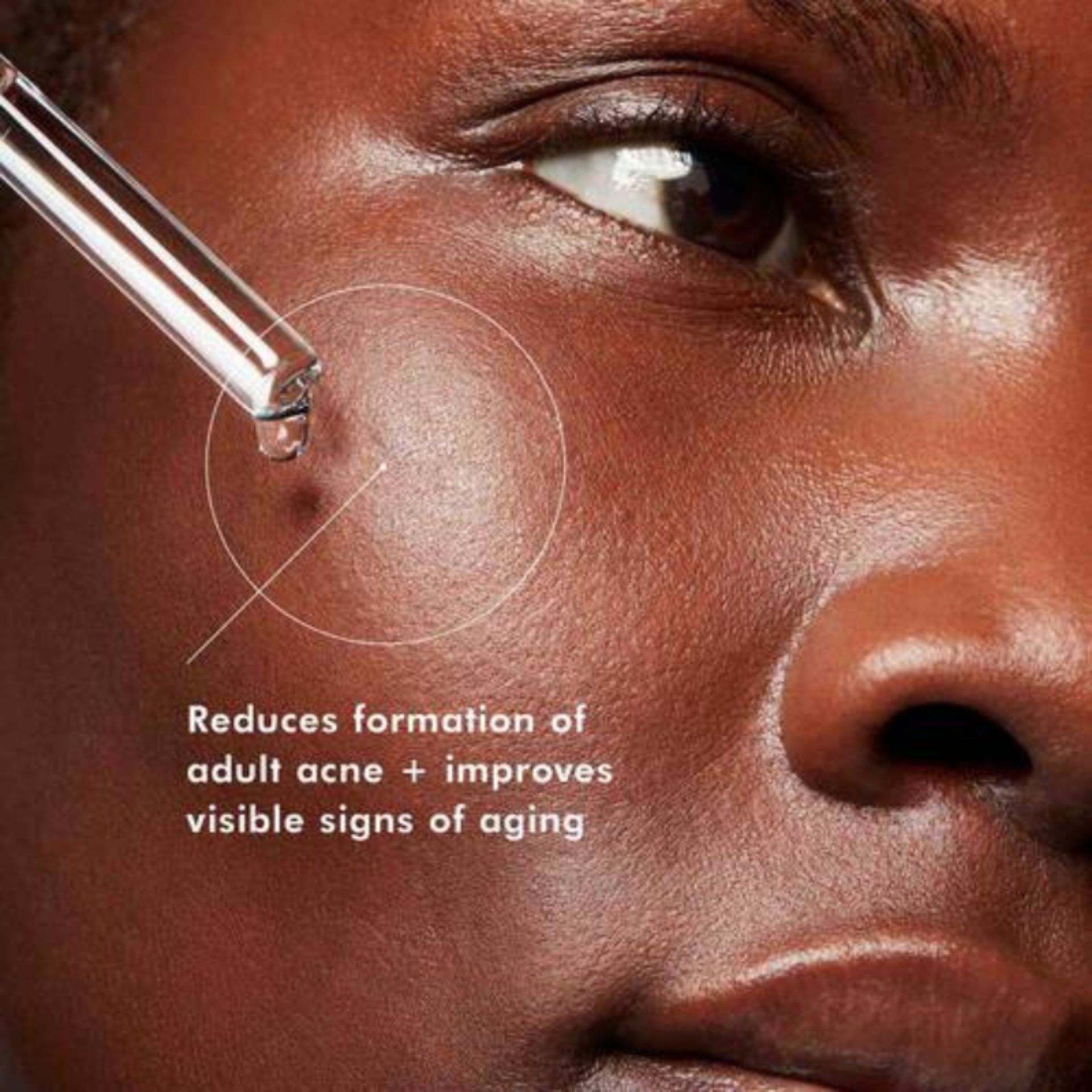 Blemish + Age Defense 30ml