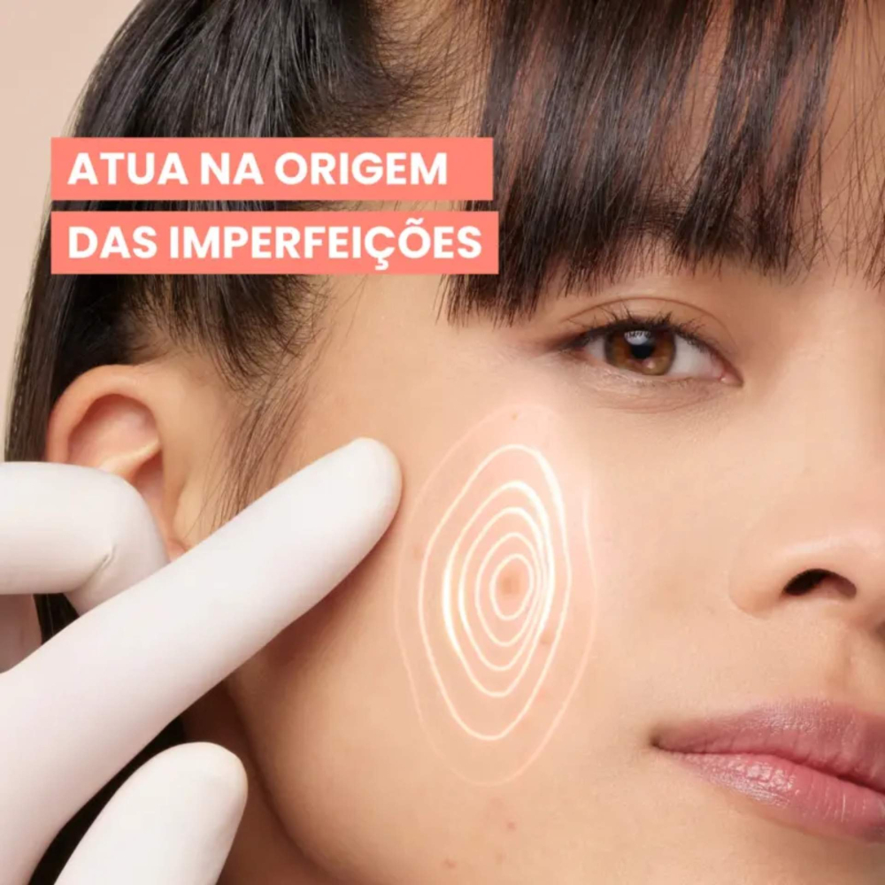 Avène Cleanance Comedomed Concentrado Anti-Imperfeições 30 ml