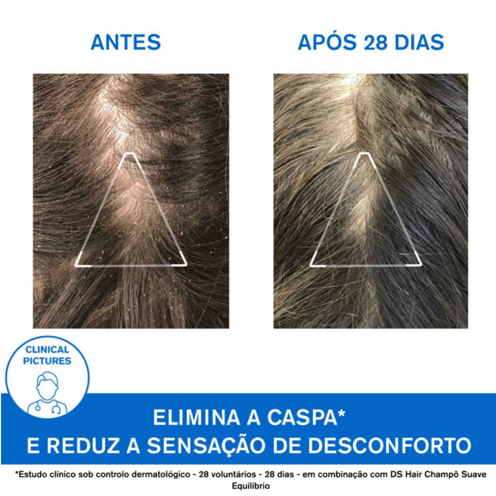Uriage DS Hair Shampoo Anticaspa 500 ml